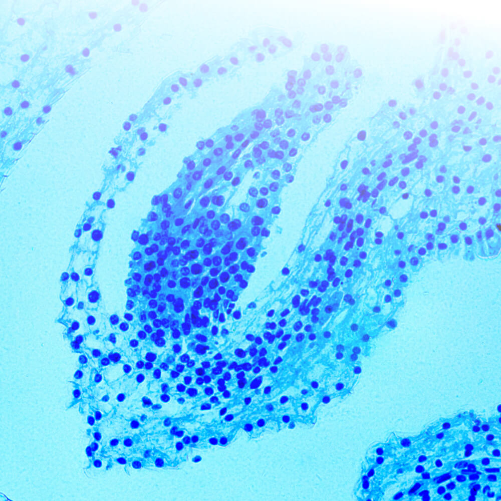 Degeneratieve aandoeningen
